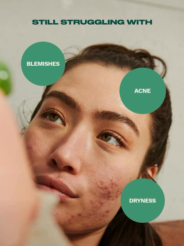 Tea that spills the benefits our Tea Tree Skin Clearing Hydrator is your glow up in a bottle. Hydrating Yes