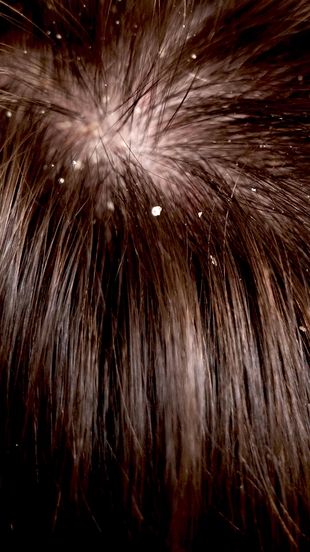 Flakes Gone Itch Handled Scalp Finally at peace With our Ginger range enriched with anti...