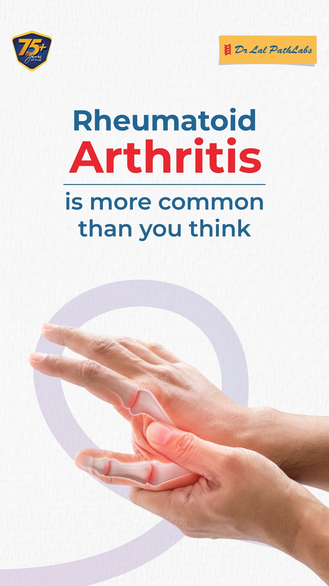 Our Rheumatoid Arthritis Panel covers 3 in depth parameters. Book your check up and take control of your health today