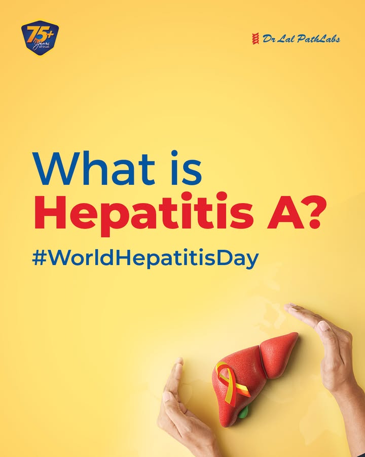 Hepatitis A spreads through contaminated food or water and often shows no early symptoms