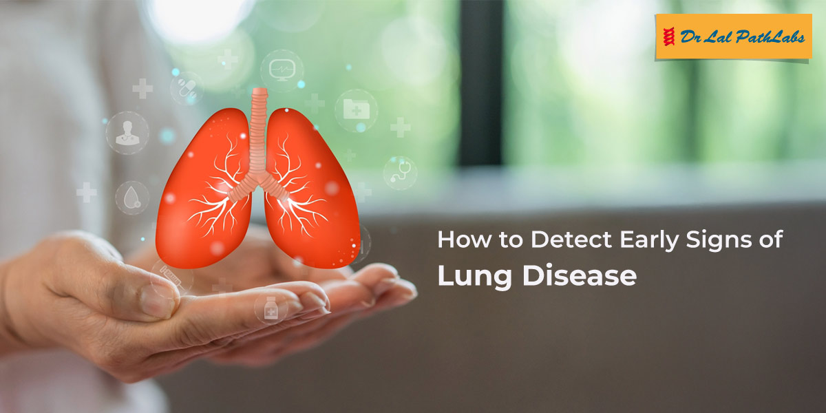 Early signs of lung disease, such as persistent cough, wheezing, shortness of breath, fatigue, chest discomfort, or unexplained weight loss, should never be ignored. Read our blog https bit.ly 3IBe2al to learn the key warning signs and next steps Early signs of lung disease, such as persistent cough, wheezing, shortness of breath, fatigue, chest discomfort, or unexplai...