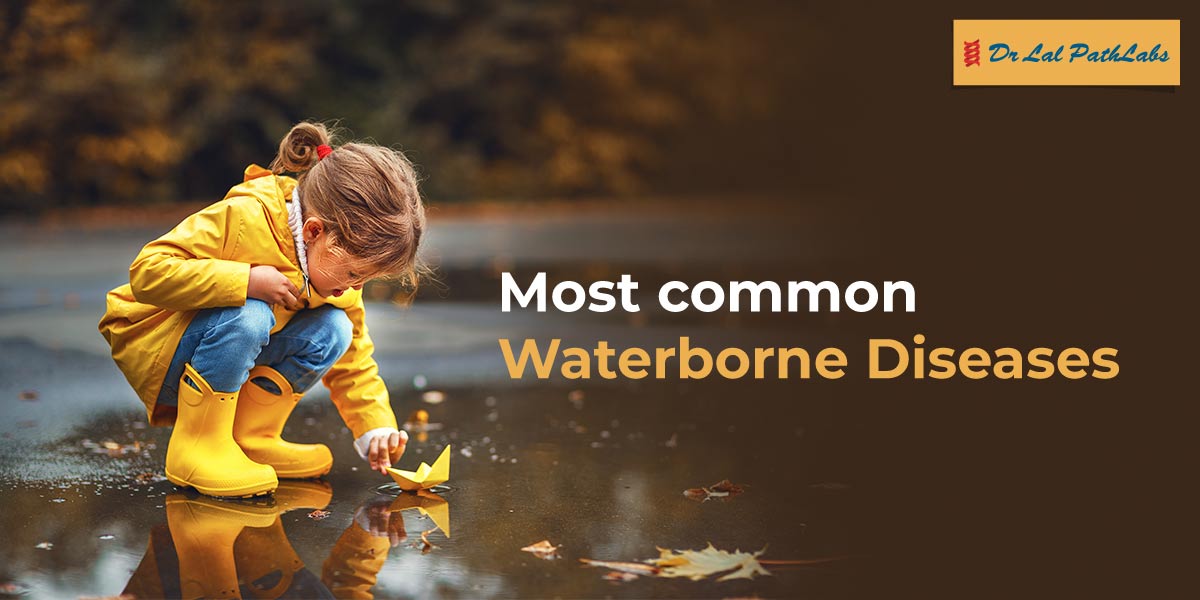 Contaminated water may lead to serious waterborne diseases like cholera, typhoid, and hepatitis A. Learn how to identify symptoms and protect your family through safe drinking water, hygiene, and timely care. Read our blog https bit Contaminated water may lead to serious waterborne diseases like cholera, typhoid, and hepatitis A