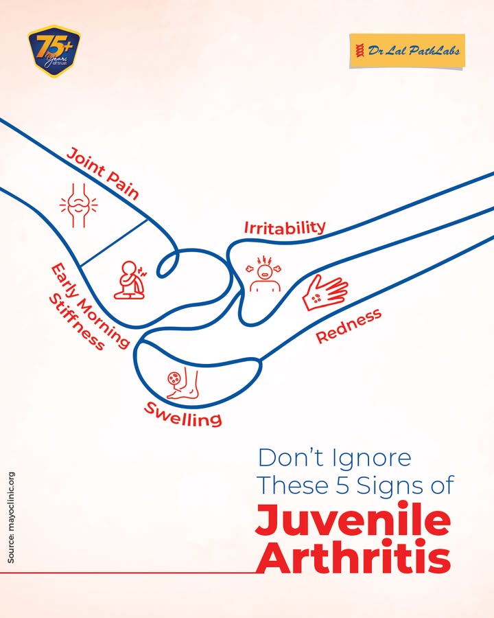 Don t overlook subtle changes in your child s well being. Recognizing the signs of Juvenile Arthritis early can make a significant difference Don t overlook subtle changes in your child s well being
