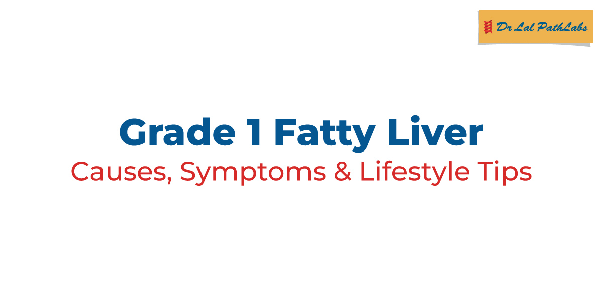 Grade 1 Fatty Liver represents the earliest stage of non alcoholic fatty liver disease