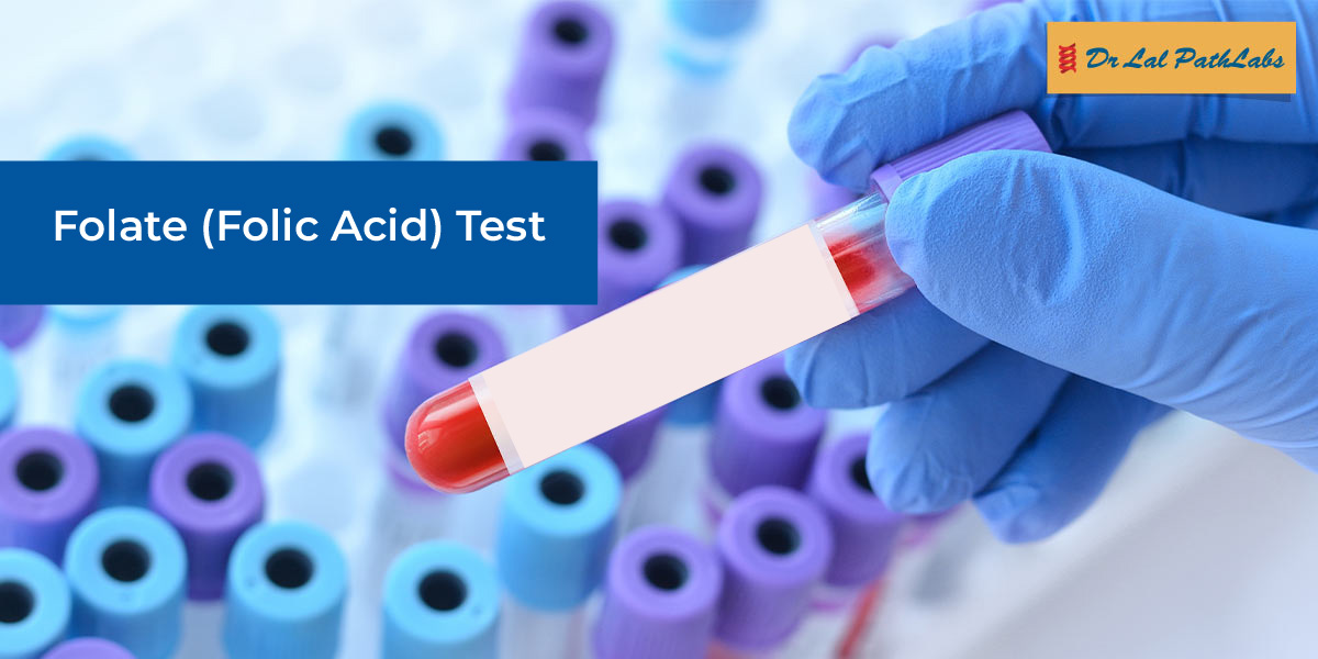 Low folate levels may cause anemia, fatigue, or complications in pregnancy. A folic acid test provides early insights to guide timely medical care. Learn more about why folate testing matters https bit Low folate levels may cause anemia, fatigue, or complications in pregnancy