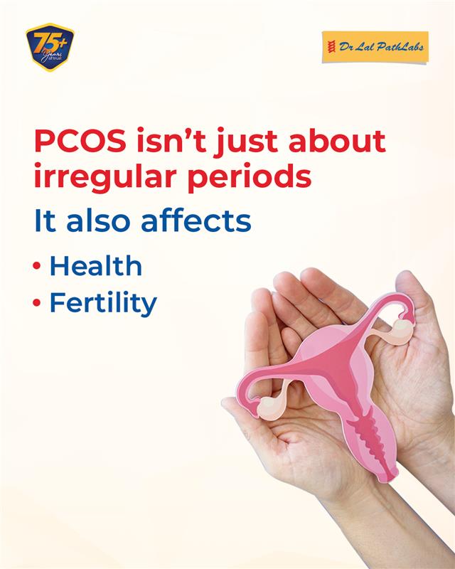 PCOS affects millions of women, often without their knowledge