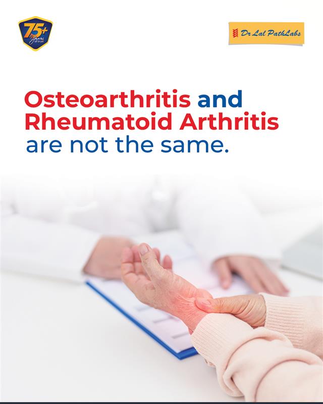 Both are forms of arthritis, but with different causes, symptoms, and care. Know the difference
