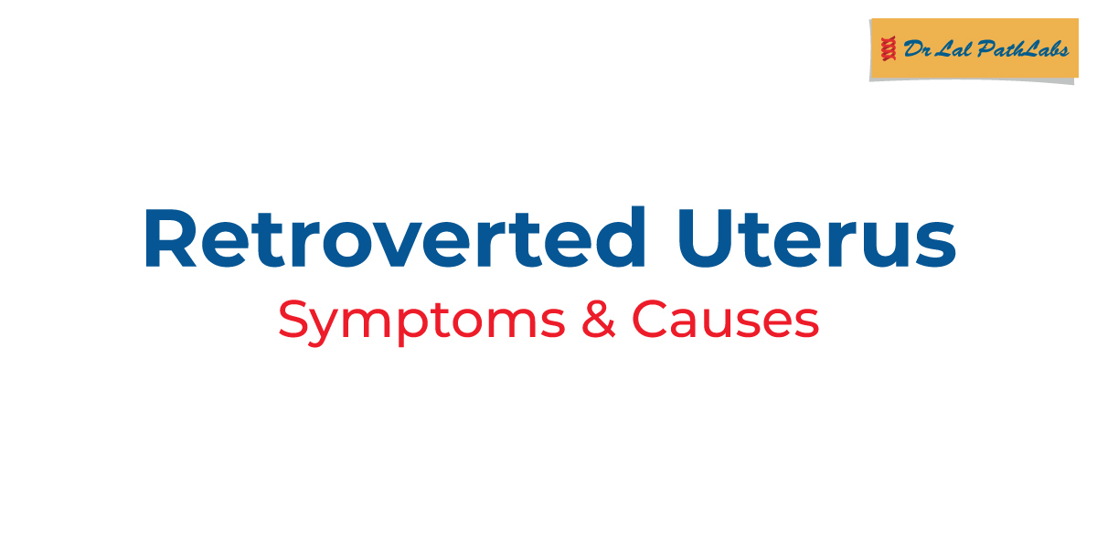 A retroverted uterus tilts backward instead of forward a common anatomical variation