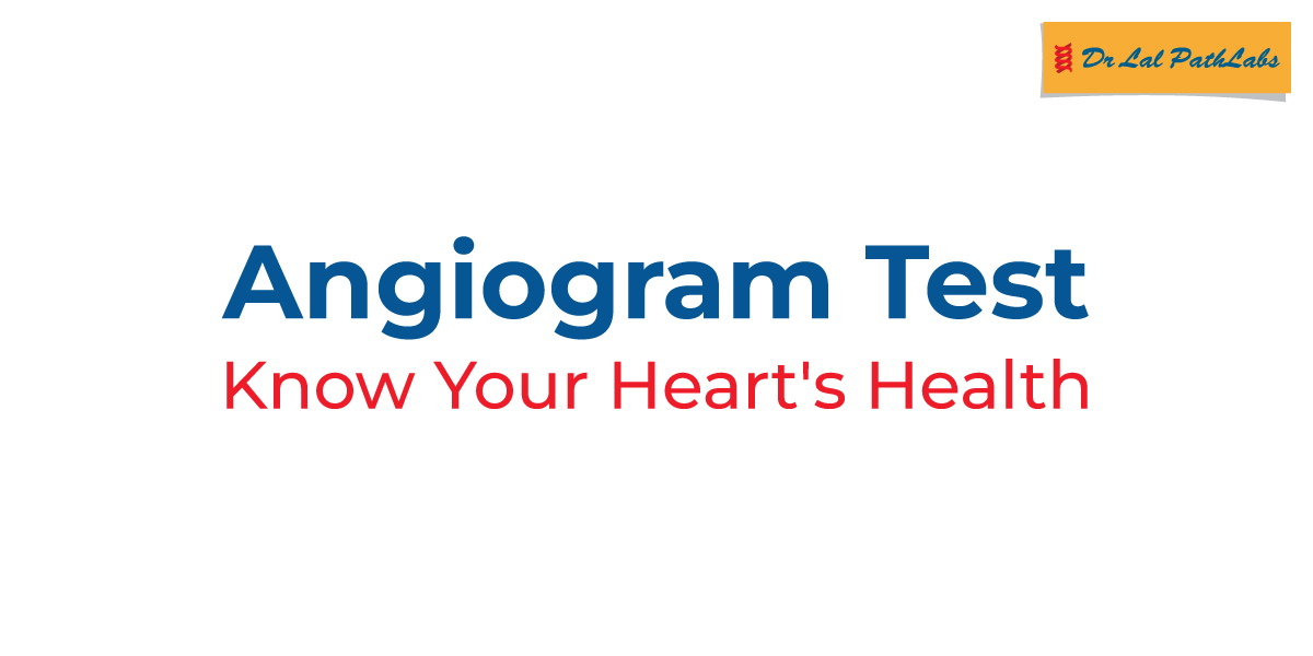 An angiogram reveals how well blood flows through the heart and vessels