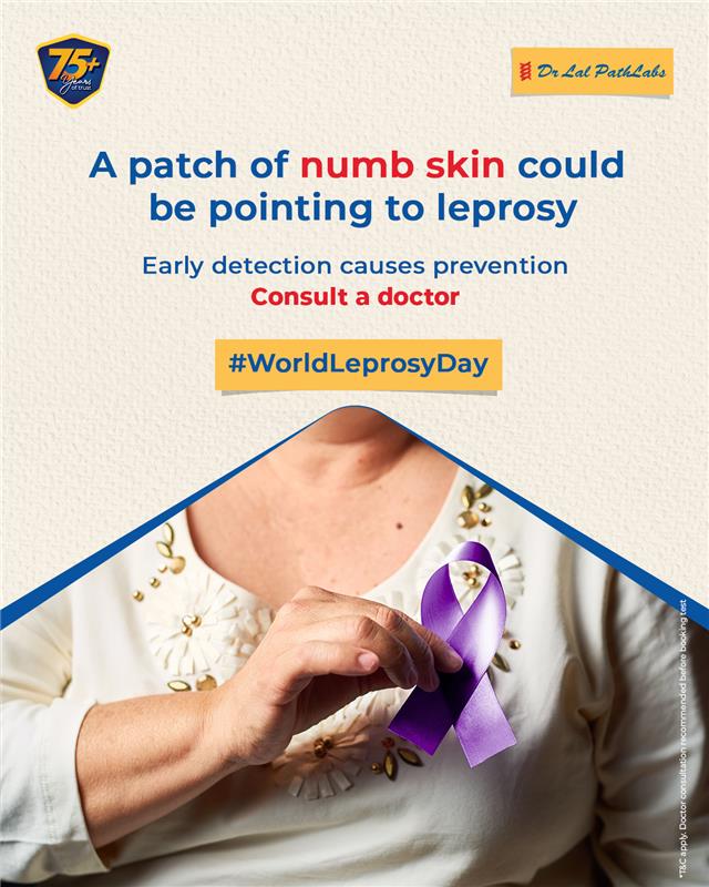 Leprosy can start with subtle signs, like a pale or reddish skin patch with loss of sensation, numbness or tingling in hands...