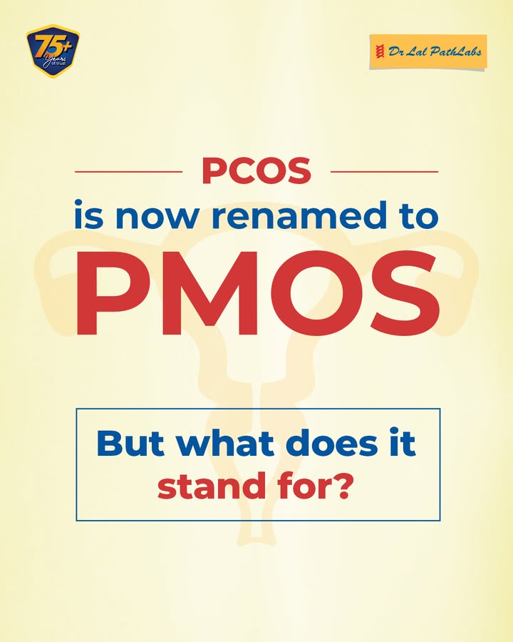  PCOS has long been associated only with ovarian cysts