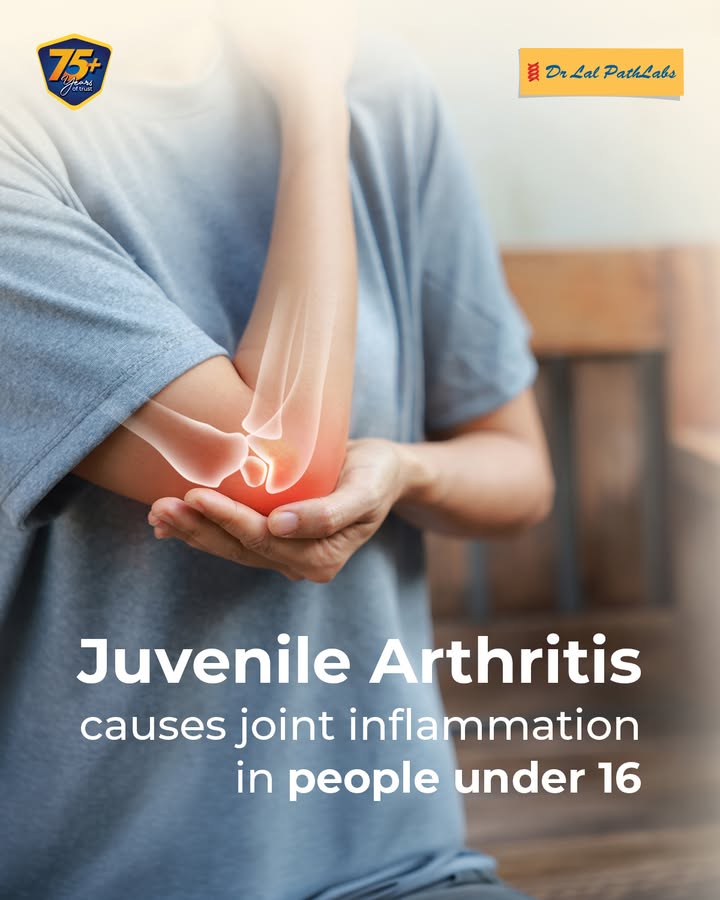 Joint pain and stiffness aren t always age related concerns. In some children, they may be signs of Juvenile Arthritis