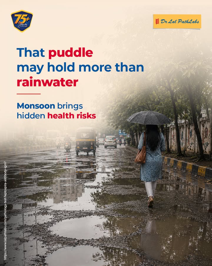 That puddle may hold more than rainwater. This monsoon, don t overlook the risk of leptospirosis