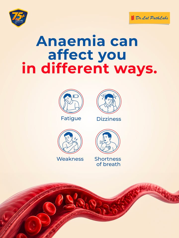 Anaemia isnt always just about feeling tired