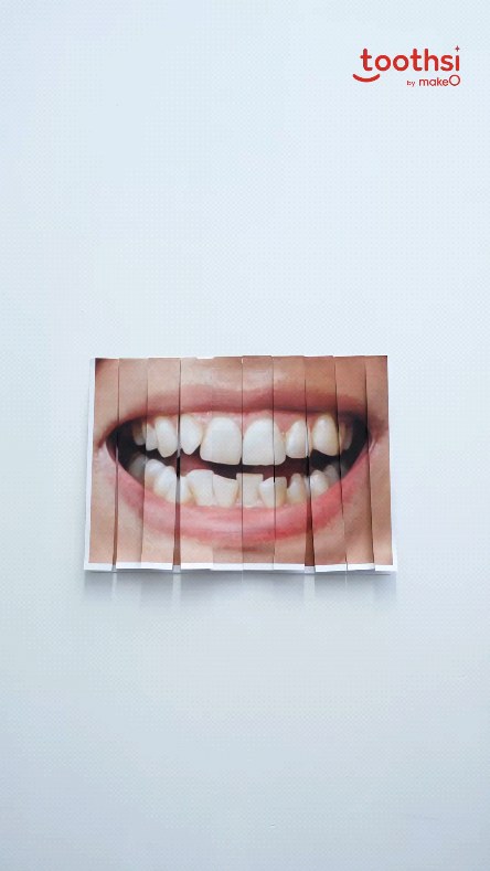 Perfectly aligned, barely visible, and customized just for you toothsi invisible aligners dont just straighten your teet...