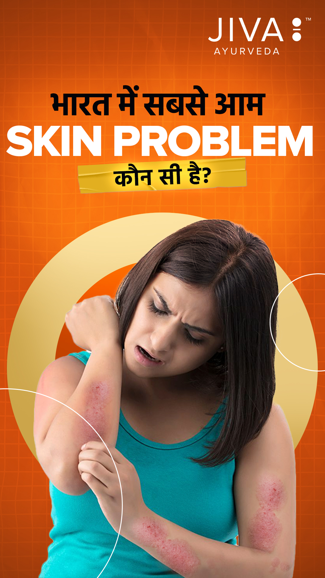 India mein sabse zyada log kis skin problem se pareshaan hain Acne Fungal infection Ya dryness Janiye is reel mein ...
