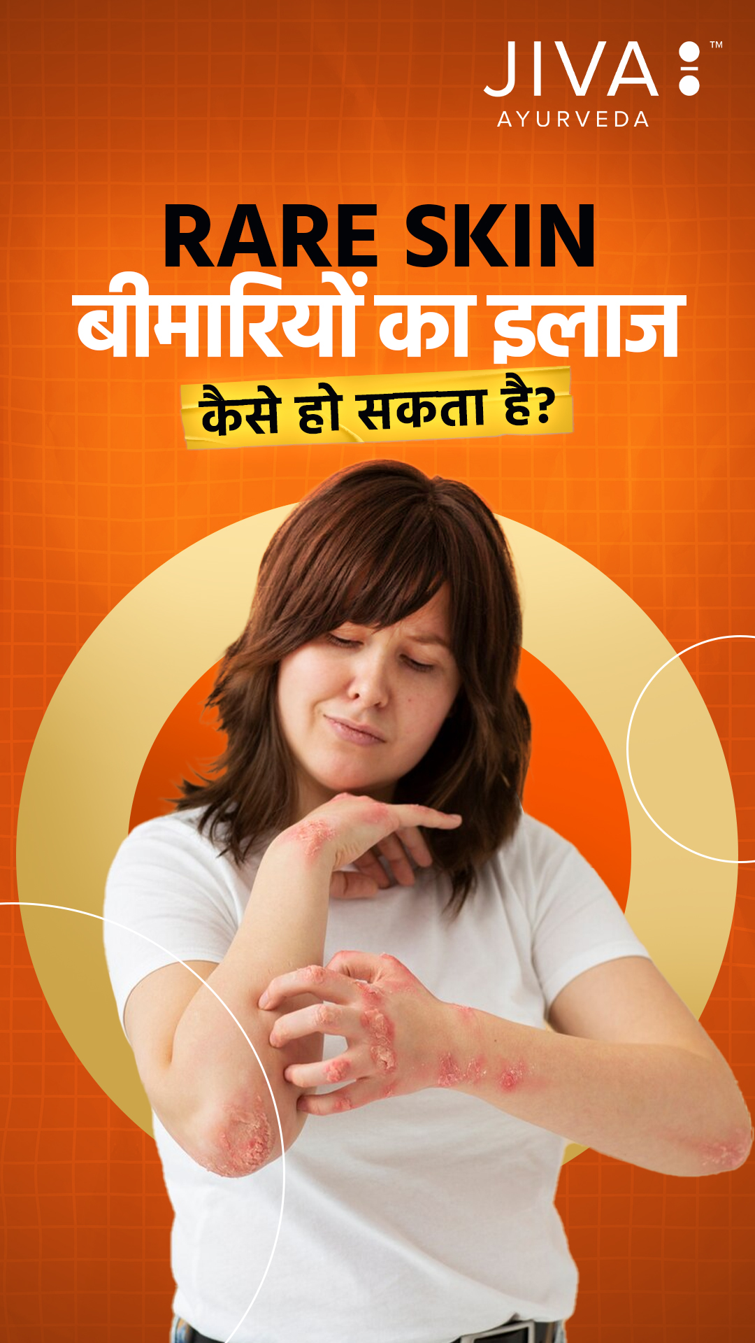  Skin diseases ka solution hai root cause ko samajhna