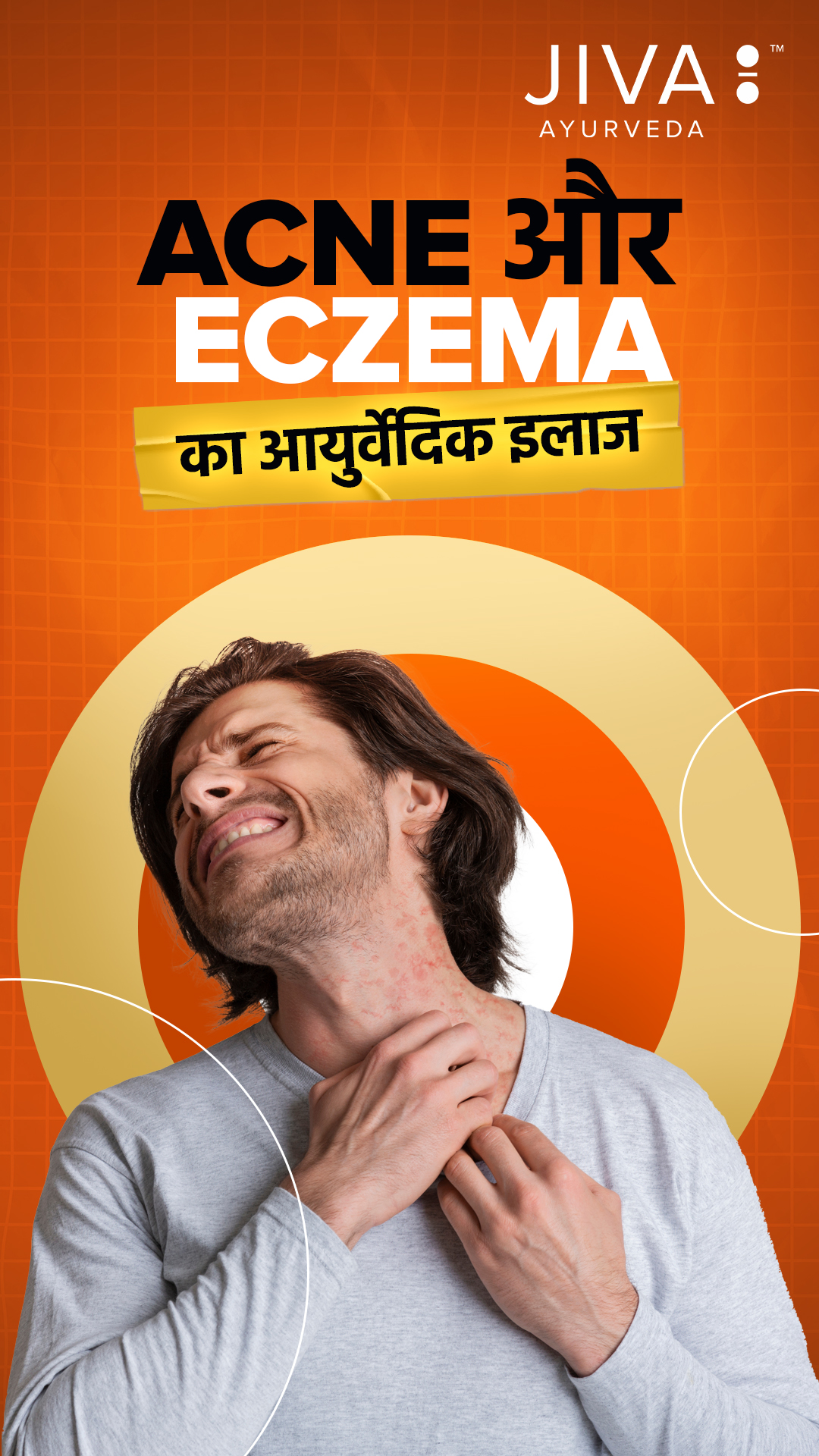Acne aur eczema se pareshan ho gaye ho Chemical creams se nahi, Ayurveda se milega jadh se ilaaj Personalised treatment, e...