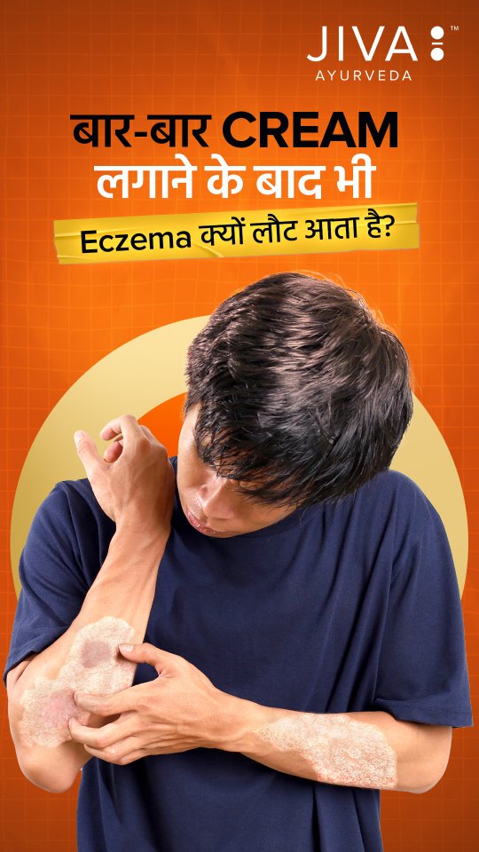  Eczema ...