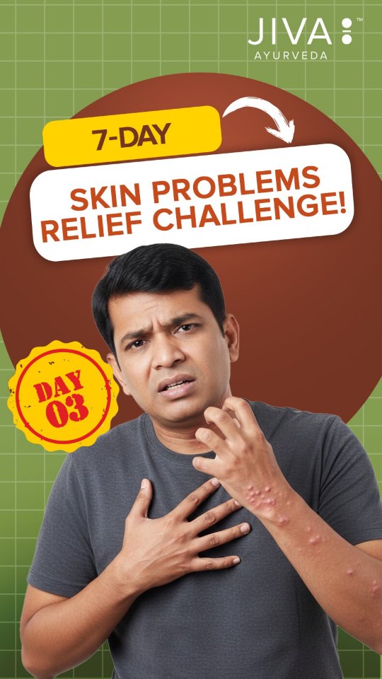 Day 3 7 Days Skin Problem Relief Challenge ...