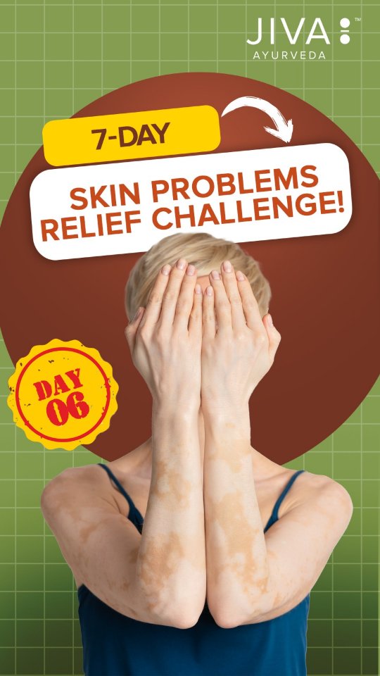 Day 6 7 Days Skin Problem Relief Challenge ...