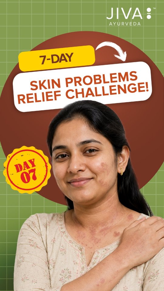 Day 7 7 Days Skin Problem Relief Challenge 6 ...