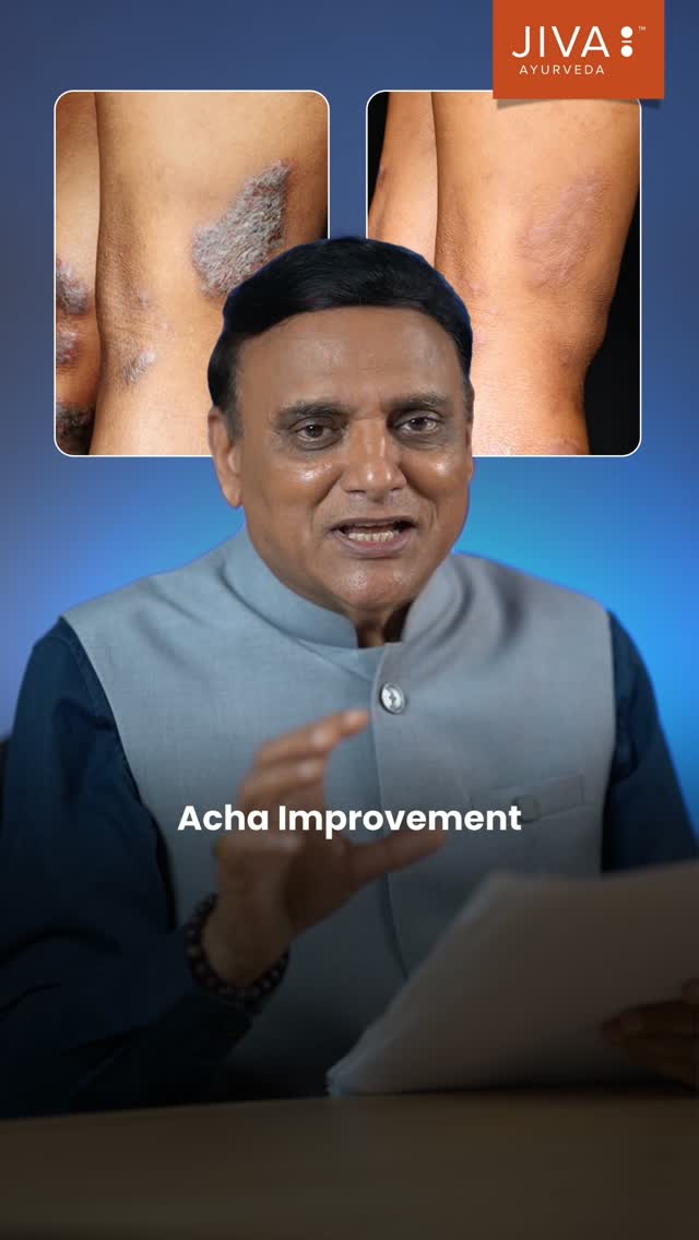Kya aapko bhi lagta tha ki eczema cure nahi ho sakta Jiva hai toh possible hai eczema CaseOfTheWeek jivaayurveda ...