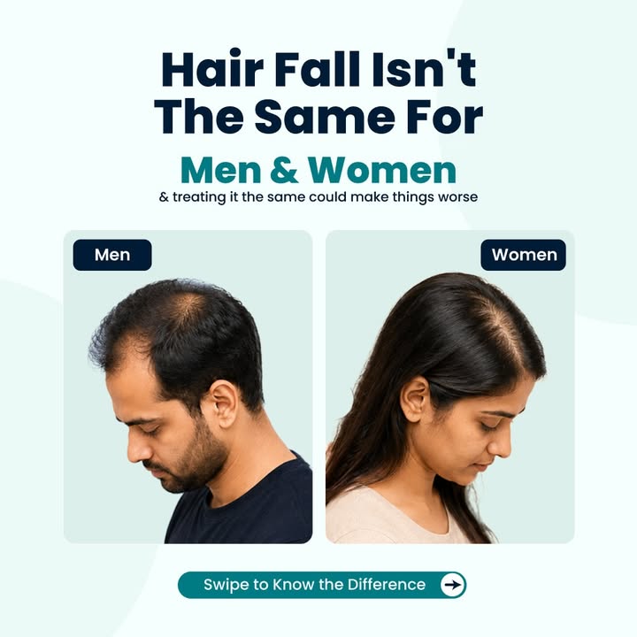 Not all hair fall is the same