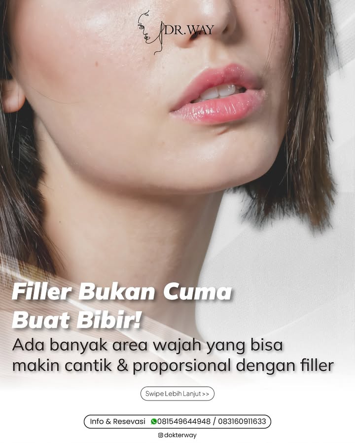  Filler bukan cuma buat bibir, lho Banyak area wajah yang bisa dibentuk lebih proposional natural dengan filler ...