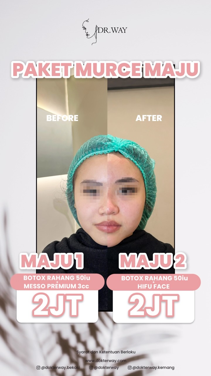  PAKET MURCE MAJU HADIR LAGI Mau treatment dengan harga lebih hemat Sekarang saatnya Pilih paket yang sesuai dengan...