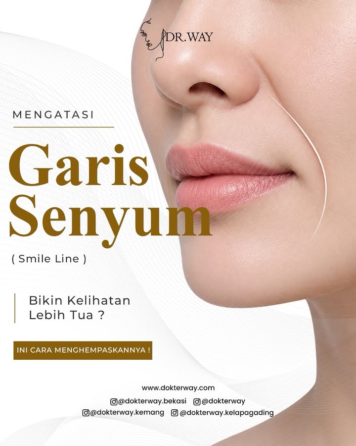 Garis senyum makin terlihat dalam dan bikin wajah tampak lebih tua Salah satu penyebabnya adalah ...