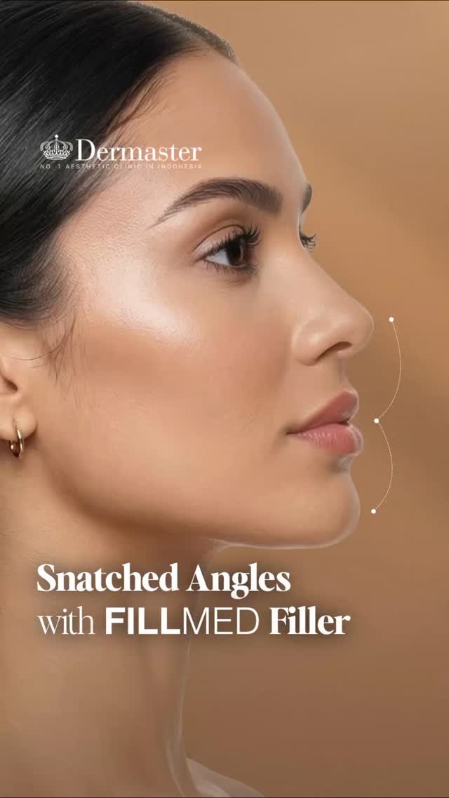 Time to Achieve Your Perfect Snatched Angles with an Exclusive 15 Discount Only This May FILLMED Filler hadir sebagai sal...
