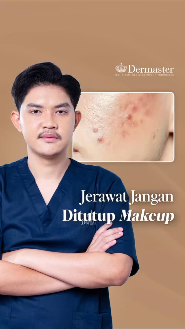 Capek Nggak Sih, Seharian Touch Up Cuma Demi Nutupin Jerawat Itu adalah salah satu indikasi bahwa kulitmu membutuhkan per...